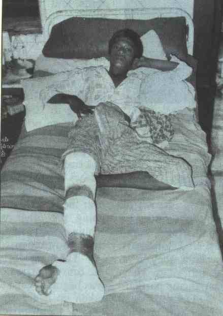 young boy wounded 1988 burma
